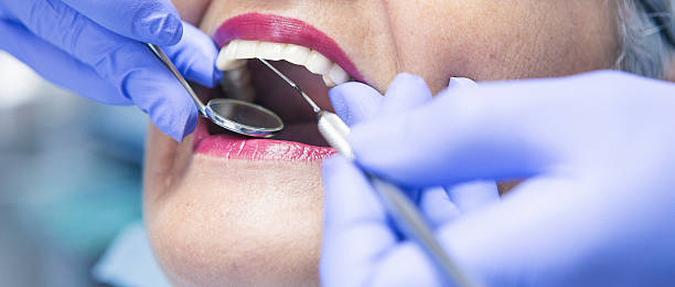 Best Emergency Dental Care for Abscessed Tooth in Blaine, WA