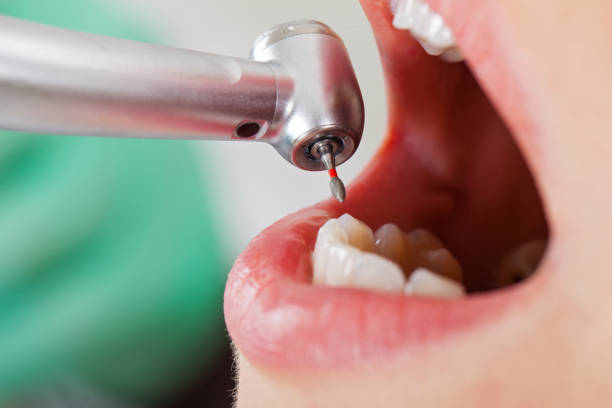 Best Emergency Dental Services for Seniors in Blaine, WA